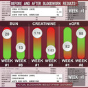 Leviathan Super Kidney Cleanse & Urinary Detox Formula | Optimal Kidney Health & Gallbladder Formula | Full Restore & Detox - Manage Kidney Stones | 120 Caps