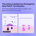 Curology Emergency Spot Pimple Patch Clusters For Breakouts, Large, Fast Acting, 14 Count