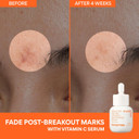 Innisfree Daily Uv Defense Spf 36  Korean Face Sunscreen, Invisible Finish, Broad Spectrum, No White Cast, Lightweight, Hydrating
