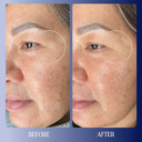 Kinship Dream Wave 2% Bio-Retinoid Overnight Ultra Hydrating Serum For Face | Retinol For Sensitive Skin | Anti Aging Niacinamide + Tranexamic Acid | Smooth Wrinkles | Redness Reducing Skin Care 1 Oz Kinship Dream Wave 2% Bio-Retinoid Overnight Ultra Hydrating Serum For Face | Retinol For Sensitive Skin | Anti Aging Niacinamide + Tranexamic Acid | Smooth Wrinkles | Redness Reducing Skin Care 1 Oz