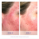 Is Clinical Pro-Heal Serum Advance+ - Antioxidant-Rich Vitamin C Serum, Calms Sensitivity & Irritation, Helps Redness, Anti-Aging