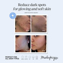 Lilyana Naturals Vitamin C Serum For Face - With Hyaluronic Acid And Vitamin E, Anti Aging Serum, Reduces Age Spots And Sun Damage, Promotes Collagen And Elastin (Double Pack) Lilyana Naturals Vitamin C Serum For Face - With Hyaluronic Acid And Vitamin E, Anti Aging Serum, Reduces Age Spots And Sun Damage, Promotes Collagen And Elastin (Double Pack)