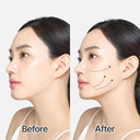 Avajar Rejuvenating Double V Mask | Double Chin Strap | Cheeks, Jowls, Jawline Shaper Face Lift | Neck Lift Mask | Chin Strap With Collagen, Niacinamide, Ceramide Np, Hyaluronic Acid | 5Pc