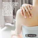 De La Cruz 10% Sulfur Ointment - Cystic Acne Treatment For Face And Body - Daily 10 Min Spot Treatment Mask - Safe And Effective Game Changing Hormonal Acne Treatment That Clears Up Pimples - 2.6 Oz