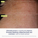 Skinfix Exo + Ectoin Intensive Repair Baume - 1 Oz - Retinol-Free Face Serum - Visibly Smooths Wrinkles + Evens Dark Spots And Redness - Fragrance Free - Vegan, Cruelty Free