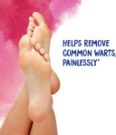 Boiron Thuja Occidentalis 30C Homeopathic Medicine For Painless Wart Removal - 80 Pellets