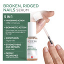 Poderm  100% Natural Nail Repair - Revitalizes Damaged And Split Nails With Hydrating & Exfoliating Formula  Effective Nail Care : Also Acts As A Nail Strengthener For Damaged Nails  Swiss Made