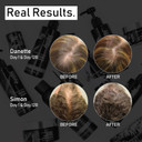 Evolis Promote Nourishing Treatment Mask - Deep Conditioning Hair Mask To Support Hair Growth - Hydrating Hair Mask For Dry, Damaged Hair - Travel Size (1 Fl Oz) Evolis Promote Nourishing Treatment Mask - Deep Conditioning Hair Mask To Support Hair Growth - Hydrating Hair Mask For Dry, Damaged Hair - Travel Size (1 Fl Oz)