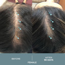 Ds Labs Revita.Sod Hair Support Tablets For Men & Women, Daily Supplement With Superoxide Dismutase, Zinc & Ashwagandha, Supports Hair Strength, Density & Visible Shedding Reduction, 30 Tablets