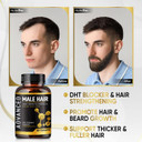 Hair Growth Vitamins For Men-Anti Hair Loss Support Vitamins Pills & Dht Blocker For Men.Regrow Hair & Beard Growth Supplement For Thicker Fuller & Stronger Hair. Support Thinning Hair With Biotin