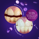 Burst Sensitive Teeth Friendly Whitening Kit | 7 Treatments With 12.5% Hydrogen Peroxide | Results In 15 Min. + Up To 6 Shades Whiter In 1 Week | Prefilled Gel Trays Burst Sensitive Teeth Friendly Whitening Kit | 7 Treatments With 12.5% Hydrogen Peroxide | Results In 15 Min. + Up To 6 Shades Whiter In 1 Week | Prefilled Gel Trays