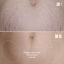 Maëlys Cosmetics B-Flat Belly Firming Cream - Stretch Mark, Tightening Belly Cream