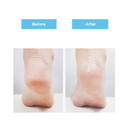 Rire Heel Exfoliating Round Arch Foot Care Stick Type 22G, With Tea Tree For Intensive Dead Skin Cell Care, Hydrating And Refreshing | Non-Sticky, Non-Irritating
