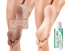 Scientific Solutions Global Bare 40 Urea Cream Lotion 40% - 4Oz Urea Lotion For Cracked Heels Treatment, Callus Remover, Dry Skin Moisturizer - Smooth Feet, Elbows, Hands, Nails