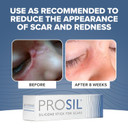 Prosil Silicone Scar Stick - Scar Gel For Surgical Scars, Acne, & Burns - Silicone Gel For Scars Is Safe For Children, Men & Women - Silicone Scar Gel Provides Effective Scar Therapy, 17G