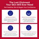 Emuaid Emuaidmax Ointment For Itchy Skin, Maximum Strength Treatment For Athlete'S Foot, Psoriasis, Jock Itch, Rash, Eczema, Cold Sores, Blisters, And Yeast Infection, 2Oz