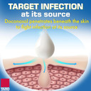 Taro Cold Sore & Fever Blister Treatment - Fast-Acting Docosanol 10% Cream - Cold Sore & Fever Blister Treatment For Lips, Anti-Itch Formula For Effective Relief And Healing - 0.07 Oz (1 Tube)