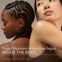 Nutrafol Clear Skin Acne Supplement For Women, Clinically Tested For Clearer, Smoother Skin, Physician-Formulated, Vegan