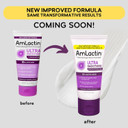 Amlactin Ultra Smoothing - 4.9 Oz Body & Hand Cream With 15% Lactic Acid - Exfoliator And Moisturizer & Daily Nourish 12% - 14.1 Oz Body Lotion With 12% Lactic Acid - Exfoliator And Moisturizer