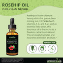 Greenive Rosehip Oil Rosa Canina 100% Pure Cold Pressed Virgin Oil Hair And Skin And Diy Products (4Oz Dropper)