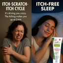 Organic Extra Strength Anti-Itch Cream For Dry, Itchy Skin Relief  Natural Fungal & Rash Treatment With Olive Leaf Extract  Fast-Acting, Long-Lasting Itch Relief