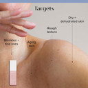 Medix 10% Glycolic Acid + Lactic Acid Leave-On Exfoliating Body Gel | Aha Exfoliant Body & Face Serum Refines + Softens Dry Dead Skin, Bumpy Skin, Uneven Skin Tone, Kp Bumps, & Wrinkles, 1.7Oz, 2Pc