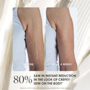 Body Firm Crepe Erase Advanced Body Repair Treatment, Anti-Aging Wrinkle Cream, Support Skins Natural Elastin & Collagen Production - 10Oz