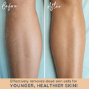 Exfoliating Glove (4 Pcs, 2 Pairs) - Heavy Exfoliate Glove For Dead Skin Bath Exfoliating Gloves For Shower Spa Massage & Body Scrub - Shower Gloves For Women & Men