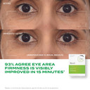 Murad Retinol Youth Renewal Eye Masks  No-Slip Under Eye Patches For Fine Lines, Wrinkles, CrowS Feet And Puffy Eyes - Full Absorption Treatment Strips