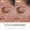 Skinfix Triple Lipid Eye Treatment - 0.5 Fl Oz - Eye Cream - Visibly Tightens, Depuffs & Smooths Undereyes - Non-Comedogenic - Fragrance Free - Vegan, Cruelty Free