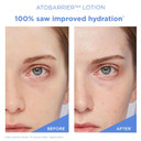 Aestura Atobarrier365 Lightweight Korean Face Moisturizer With Ceramides | Strengthens Barrier, Fast-Absorbing Hydration, Suitable For Dry, Normal & Sensitive Skin, 90Ml / 3.04 Fl. Oz Aestura Atobarrier365 Lightweight Korean Face Moisturizer With Ceramides | Strengthens Barrier, Fast-Absorbing Hydration, Suitable For Dry, Normal & Sensitive Skin, 90Ml / 3.04 Fl. Oz