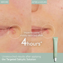 Caudalie Vinopure Color Correcting Spot Solution With Salicylic Acid - 15 Ml