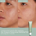 Caudalie Vinopure Oil Control Moisturizer For Acne-Prone Skin, Hydrating & Mattifying Moisturizer - 40 Ml