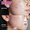 Handmade Heroes 2% Bakuchiol Oil With Sugarcane Squalane, All Natural Retinol Alternative Facial Oil For Radiant And Line Smoothing, Travel Size Skincare 0.3 Fl Oz