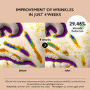 Haruharu Wonder Centella Phyto And 5 Peptide Concentrate Cream & Black Rice Facial Oil Bundle