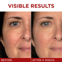 L'Oreal Paris Revitalift Triple Power Face And Neck Moisturizer, Anti Aging Face Cream With Broad Spectrum Spf 30, Pro-Retinol, Hyaluronic Acid And Vitamin C, 1 Kit