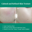 Nightingale Teatree Calming Pads, Facial Toner Pads With Tea Tree & Pha, Low Ph Daily Toner Pads, Soothing For Sensitive & Irritated Skin, Hypoallergenic, Vegan Pads, Korean Skin Care Nightingale Teatree Calming Pads, Facial Toner Pads With Tea Tree & Pha, Low Ph Daily Toner Pads, Soothing For Sensitive & Irritated Skin, Hypoallergenic, Vegan Pads, Korean Skin Care