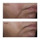 No:Rinse Intensive Pore Minimizing Toner, 4 Fl. Oz