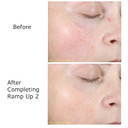 0.05% Retinol Cream, R2 Night Cream For Face, Skin Care Routine, Daily Face Moisturizer, Contains Vitamin C & Bakuchiol, Brighten & Rejuvenation *Activator Sold Separately