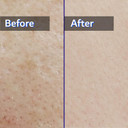 Hydrating Toner 10.14 Fl Oz - Korean Skin Care, Moisturizing Calming Toner, Vegan + Animal Testing Free, Sensetive Skin, Daily Facial & Ultra Hydrate, Natural Ingredients