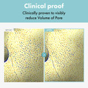 Pore Refiner Cream, Face Cream, Pore Extractor, Pore Minimize & Reducer And Remover. Best Pore Minimizer Treatment. Moisturizer For Oily Skin. K Beauty, Korean Skincare, 50G, 1.76 Oz Pore Refiner Cream, Face Cream, Pore Extractor, Pore Minimize & Reducer And Remover. Best Pore Minimizer Treatment. Moisturizer For Oily Skin. K Beauty, Korean Skincare, 50G, 1.76 Oz