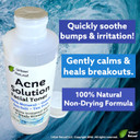 Urban Releaf Acne Solution Facial Toner! Sea Salt & Tea Tree. Soothe Skin, Calm Breakouts. 4 Oz. Gentle Effective. 100% Natural & Soothing. Reduce The Appearance Of Pores