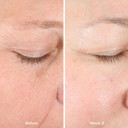 Beekman 1802 Golden Booster Amla Berry Face Serum - Fragrance Free - 1 Fl Oz - Plant-Based Vitamin C Alternative - Good For Sensitive Skin - Cruelty Free