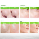 Blackhead Remover Mask, Charcoal Peel Off Face Mask, Blackhead Remover, Pore Cleaner For Men & Women, 2.7 Fl Oz