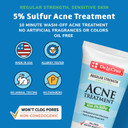 De La Cruz 5% Sulfur Ointment - Cystic Acne Treatment For Face And Body - Daily 10 Min Spot Treatment Mask - Safe And Effective Game Changing Hormonal Acne Treatment That Clears Up Pimples 2.6Oz Tube