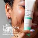 Dr Dennis Gross Alpha Beta® On The Spot Eliminator, 2% Salicylic Acid Spot Treatment, 1 Fl Oz