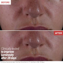 Erborian Skin Therapy Night Serum, For Wrinkles & Even Texture, Visible Results After 1St Night, Hydrating, 10% Pha & Hyaluronic Acid, Korean Skincare