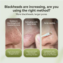 Lanbena 3 In 1 Blackhead Removing Set, Pore Strips 30G+Pore Serum 30Ml+Removal Strip Paper, Black Head Remover Mask For Face, Pore Minimizer & Reducer For Face, Leaving Your Skin Fresh And Clean
