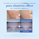 Medicube Zero Exosome Shot 25,000 Ppm Spicule Facial Serum | Liquid Skin Booster Serum | Exosome, Aha+Bha+Pha | Pore Care, Dead Skin Cells, Skin Texture | Korean Skin Care 0.43 Fl.Oz