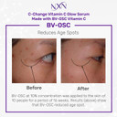 Nxn Vitamin C & Hyaluronic Acid Serum Set, Clinically Proven To Brighten Skin, Reduce Dark Spots, Improve Hyper Pigmentation Age Spots, Reduce Fine Lines & Wrinkles - 1Fl Oz Face Kit